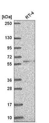 Western Blot: HUCE1 Antibody [NBP2-55730]