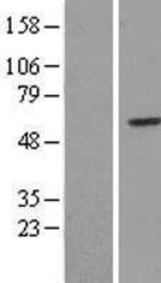 Western Blot: HUCE1 Overexpression Lysate [NBL1-12247]