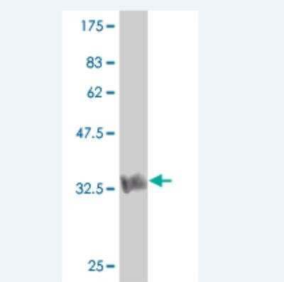 Western Blot: HUNK Antibody (1E4) [H00030811-M02]