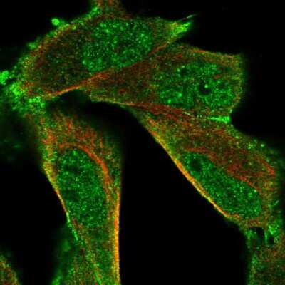 Immunocytochemistry/ Immunofluorescence: HUNK Antibody [NBP2-14110]