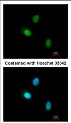 Immunocytochemistry/ Immunofluorescence: HUNK Antibody [NBP2-16904]