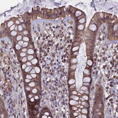 Immunohistochemistry-Paraffin: HUNK Antibody [NBP2-14110]