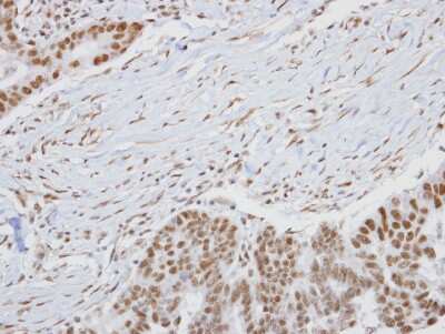 Immunohistochemistry-Paraffin: HUNK Antibody [NBP2-16904]