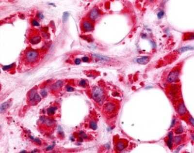 Immunohistochemistry-Paraffin: HUNK Antibody - BSA Free [NLS7095]