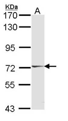 Western Blot: HUNK Antibody [NBP2-16904]