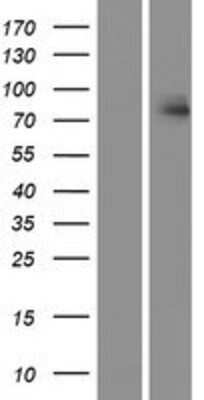 Western Blot: HUNK Overexpression Lysate [NBP2-07313]