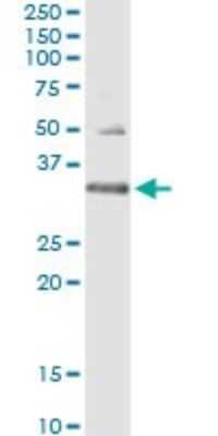 Immunoprecipitation: HUS1 Antibody (2B12) [H00003364-M01]