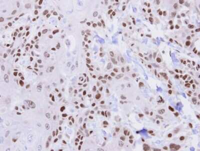 Immunohistochemistry-Paraffin: HUS1 Antibody [NBP1-33589]