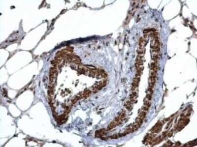 Immunohistochemistry-Paraffin: HUS1 Antibody [NBP1-33589]