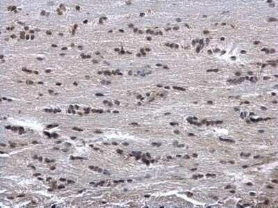 Immunohistochemistry-Paraffin: HUS1 Antibody [NBP1-33589]