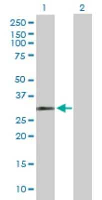 Western Blot: HUS1 Antibody [H00003364-D01P]