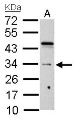 Western Blot: HUS1 Antibody [NBP1-33589]