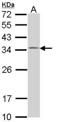 Western Blot: HUS1 Antibody [NBP1-33589]