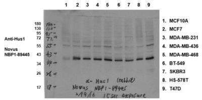 Western Blot: HUS1 Antibody [NBP1-89445]