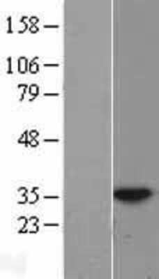 Western Blot: HUS1 Overexpression Lysate [NBL1-11788]