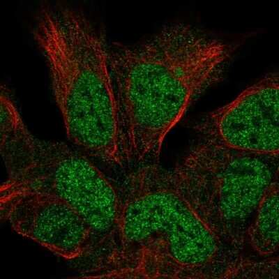 Immunocytochemistry/ Immunofluorescence: HUS1B Antibody [NBP2-56023]