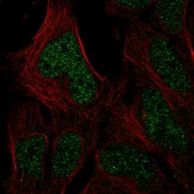 Immunocytochemistry/ Immunofluorescence: HUS1B Antibody [NBP2-56691]