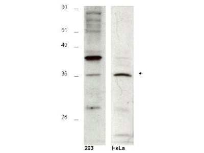 Western Blot: HUS1B Antibody [NBP1-77749]