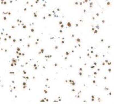 Immunocytochemistry/ Immunofluorescence: HUWE1 Antibody (BLR129H) [NBP3-14712]