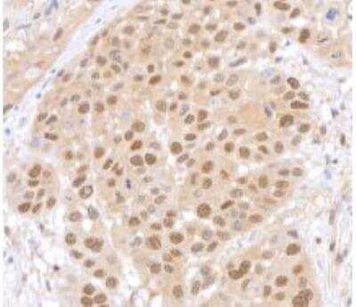 Immunohistochemistry-Paraffin: HUWE1 Antibody (BLR129H) [NBP3-14712]