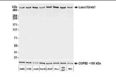 Western Blot: HUWE1 Antibody (BLR129H) [NBP3-14712]