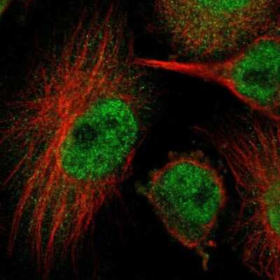 Immunocytochemistry/ Immunofluorescence: HUWE1 Antibody [NBP1-83127]