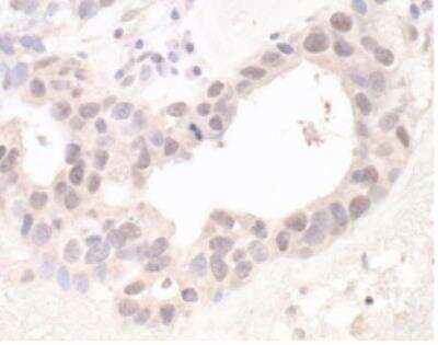Immunohistochemistry-Paraffin: HUWE1 Antibody [NB100-652]