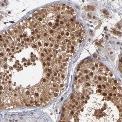 Immunohistochemistry-Paraffin: HUWE1 Antibody [NBP1-83127]