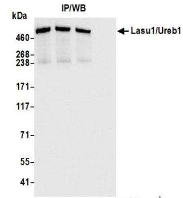 Immunoprecipitation: HUWE1 Antibody (BLR129H) [NBP3-14712]
