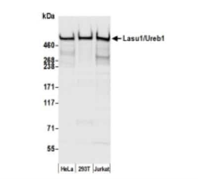 Western Blot: HUWE1 Antibody [NB100-652]