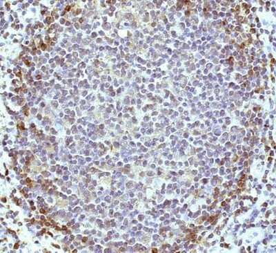 Immunohistochemistry-Paraffin: HVCN1 Antibody [NBP1-06585]