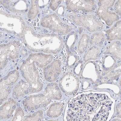 Immunohistochemistry-Paraffin: HVCN1 Antibody [NBP1-81643]