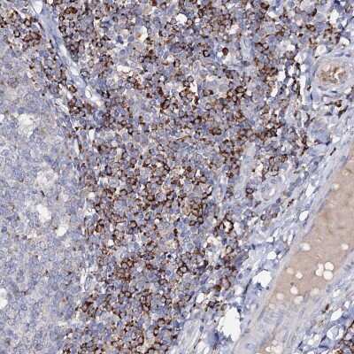 Immunohistochemistry-Paraffin: HVCN1 Antibody [NBP1-81643]