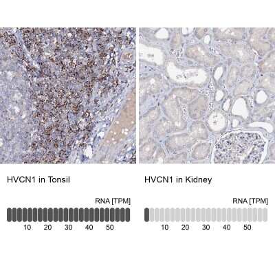 Immunohistochemistry-Paraffin: HVCN1 Antibody [NBP1-81643]