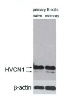 Western Blot: HVCN1 Antibody [NBP1-06585]