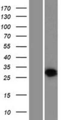 Western Blot: HVCN1 Overexpression Lysate [NBP2-08501]