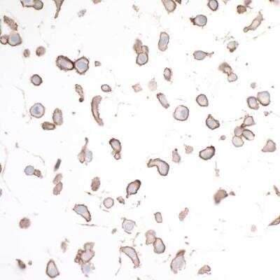 Immunocytochemistry: HVEM/TNFRSF14 Antibody (BLR062G) [NBP2-78834]