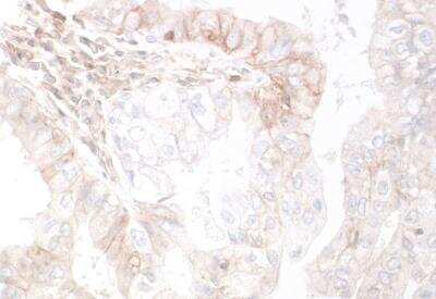 Immunohistochemistry-Paraffin: HVEM/TNFRSF14 Antibody (BLR062G) [NBP2-78834]