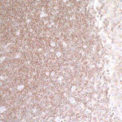 Immunohistochemistry-Paraffin: HVEM/TNFRSF14 Antibody (BLR062G) [NBP2-78834]