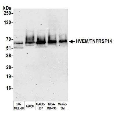 Western Blot: HVEM/TNFRSF14 Antibody (BLR062G) [NBP2-78834]