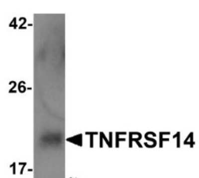 Western Blot: HVEM/TNFRSF14 AntibodyBSA Free [NBP1-76689]