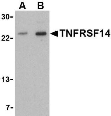Western Blot: HVEM/TNFRSF14 AntibodyBSA Free [NBP1-76690]