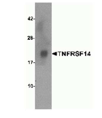 Western Blot: HVEM/TNFRSF14 AntibodyBSA Free [NBP1-76690]