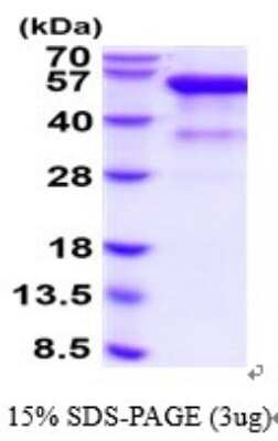 SDS-PAGE: Recombinant Human HVEM/TNFRSF14 hIgG-His Protein [NBP2-52356]