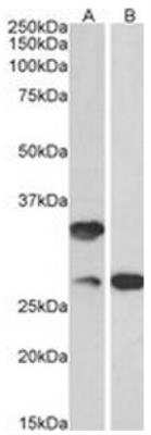 Western Blot: HVSL1 Antibody [NBP1-97768]