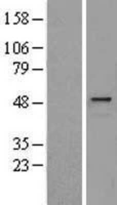 Western Blot: Hyaluronidase 1/HYAL1 Overexpression Lysate [NBL1-11791]