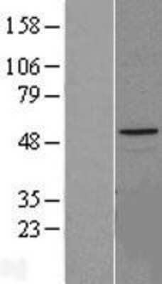 Western Blot: Hyaluronidase 1/HYAL1 Overexpression Lysate [NBL1-11792]