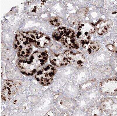 Immunohistochemistry-Paraffin: HYAL2 Antibody [NBP1-81283]