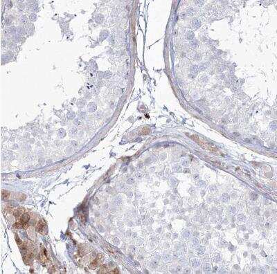 Immunohistochemistry-Paraffin: HYAL2 Antibody [NBP1-81283]