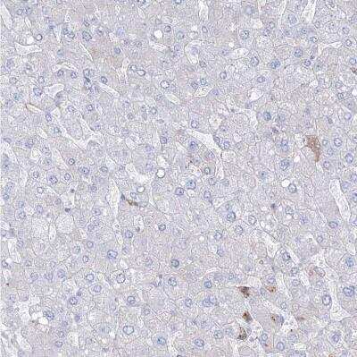 Immunohistochemistry-Paraffin: HYAL2 Antibody [NBP1-81283]